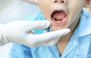 Dentist examining a child’s tongue-tie